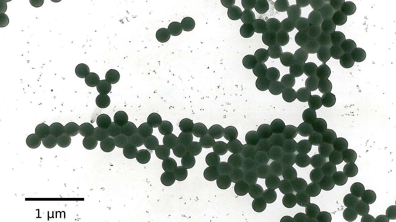 Latexpartikel als REM-Aufnahme wor wei&szlig;em Hintergrund 